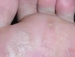 脚底长了像水泡一样的东西很痒什么原因（脚底长了像水泡一样的东西很痒什么原因呢）